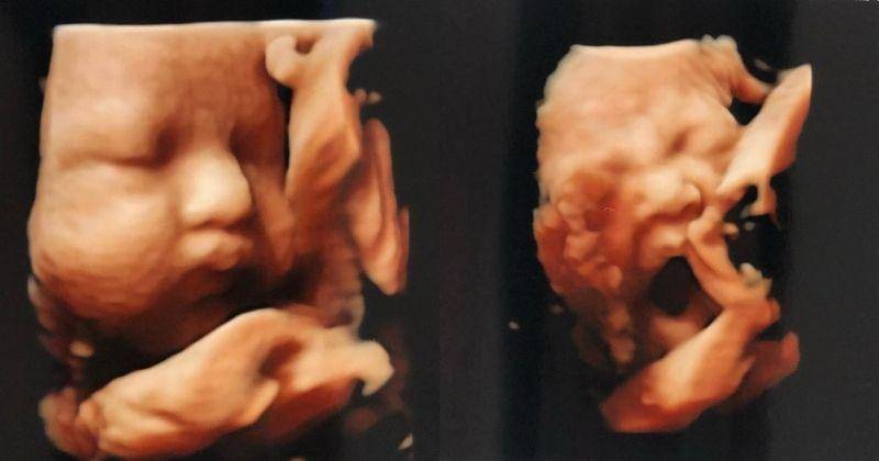 Instagram.com/rogerojey