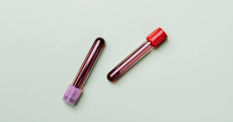 Pexels/Karolina Grabowska