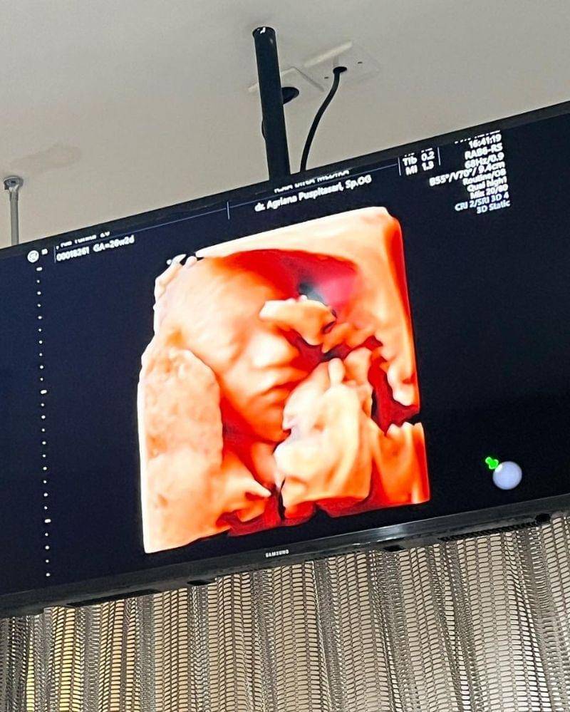 Instagram.com/riaricis1795