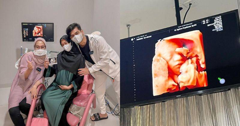 Instagram.com/riaricis1795