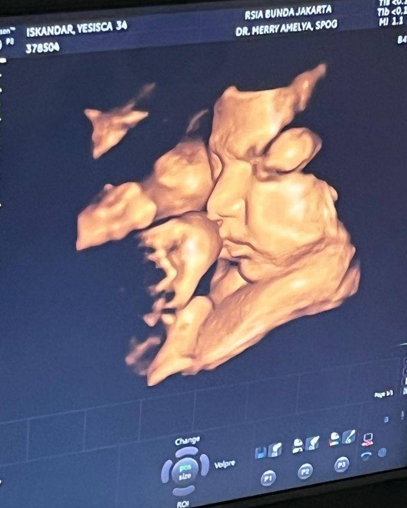 Instagram.com/v.andrianto