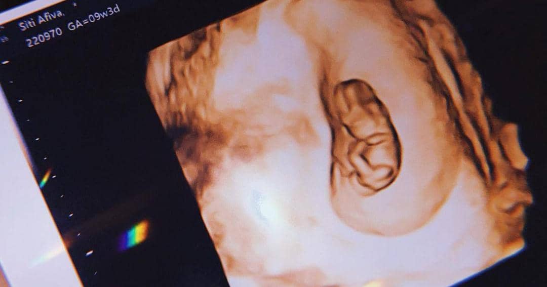 Instagram.com/rsn.dw