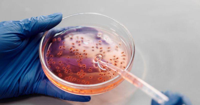 Pexels/Edward-jenner