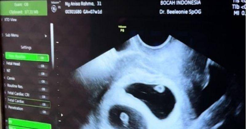 Instagram.com/@anisarahma_12