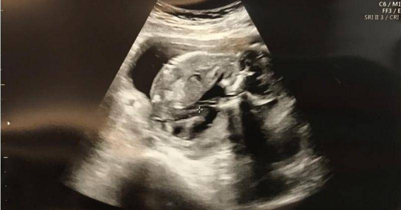 Instagram.com/@aryanifitriana24