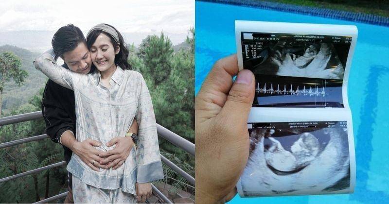 Instagram.com/@ardinarasti6