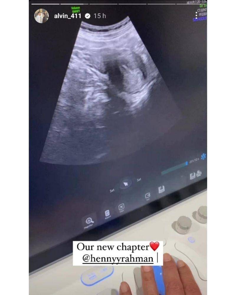 Instagram.com/@alvin_411