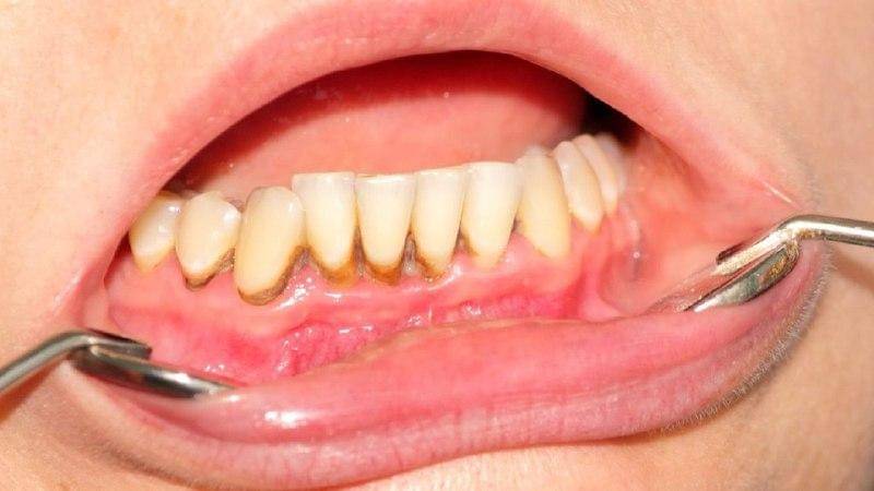 Smilepointdental.com