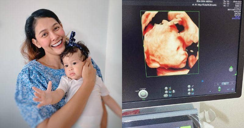 Instagram.com/bungajelitha66