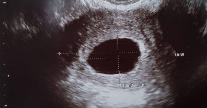 Pinterest.com/Malorey