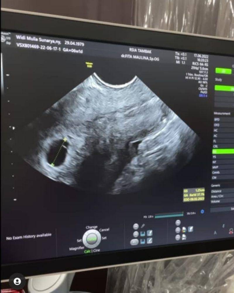 Instagram.com/@widimulia