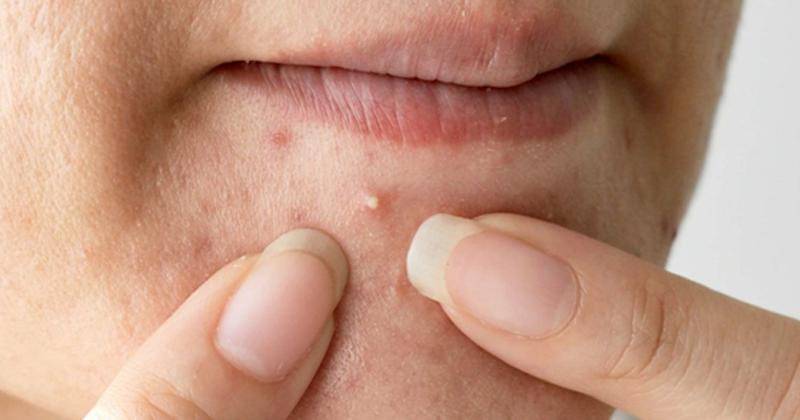 medicalnewstoday.com