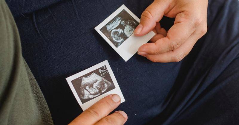 Pexels/Amina Filkins