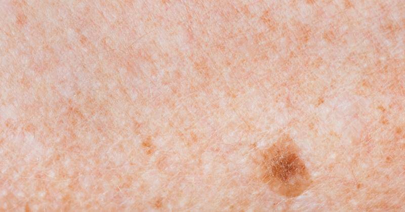 Freepik/rawpixel.com