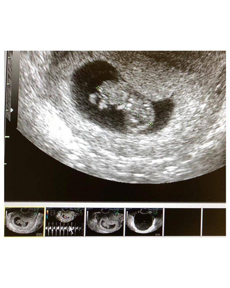 Instagram.com/@kahi_korea