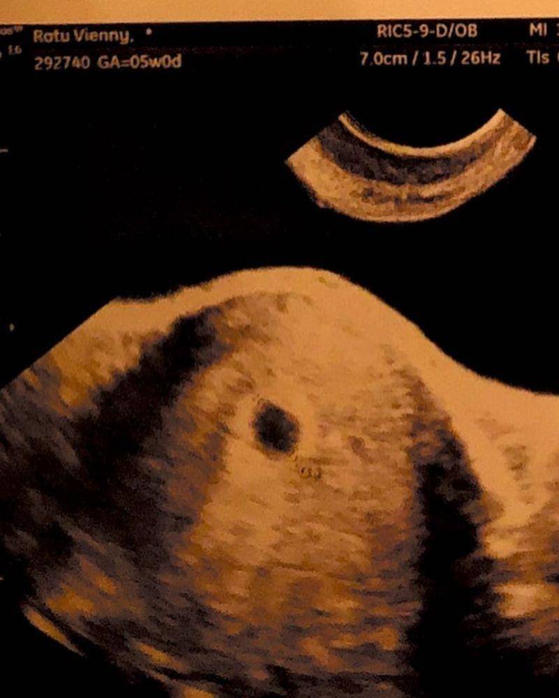 Instagram.com/itskindavienny