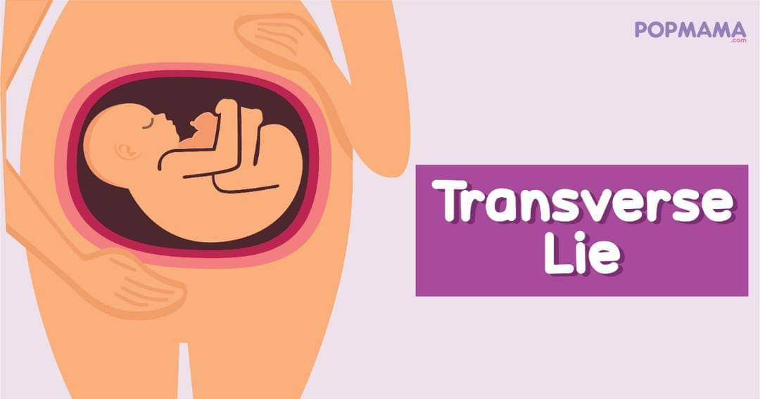 Popmama.com/Aristika Medinasari