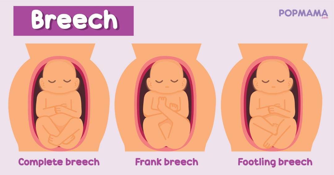 Popmama.com/Aristika Medinasari