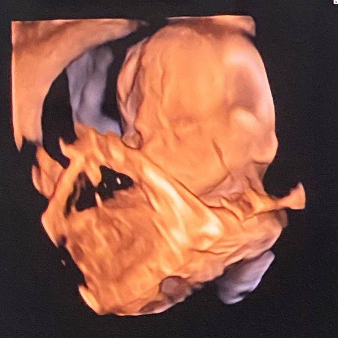 Instagram.com/@cantitachril