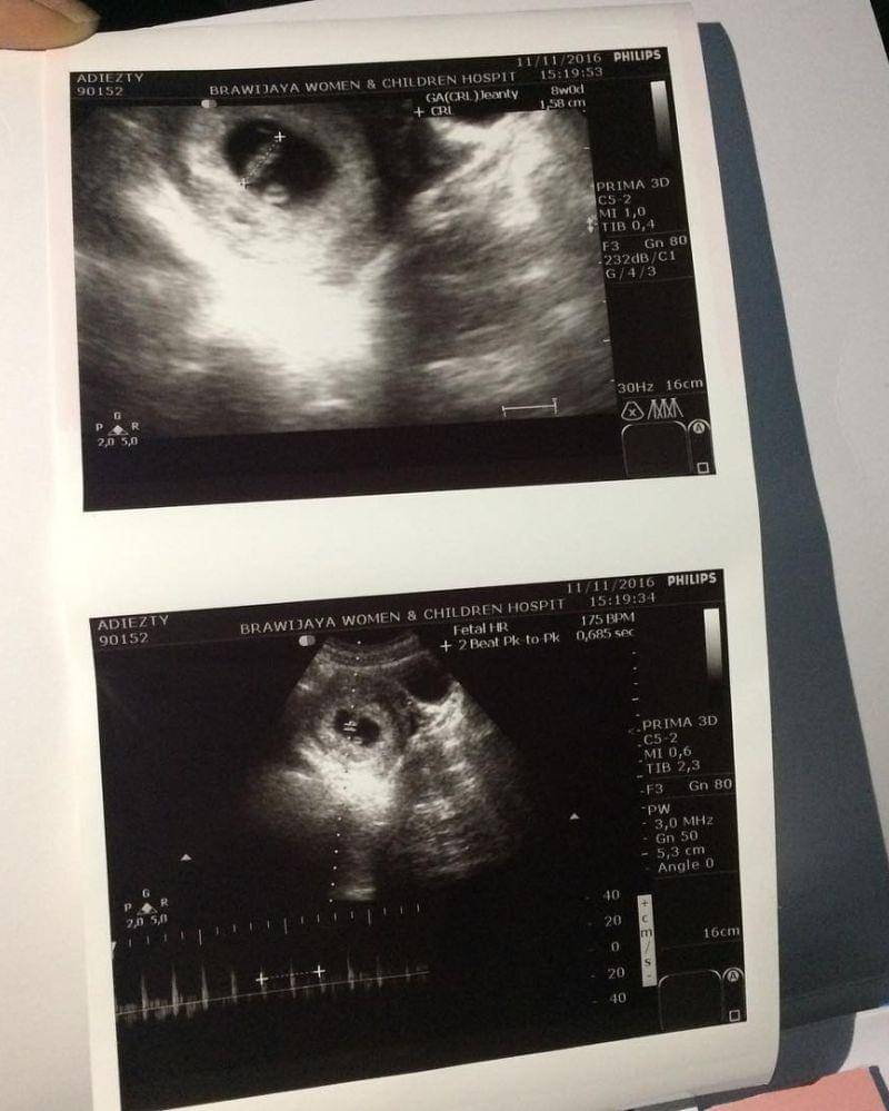 Instagram.com/gilangdirga