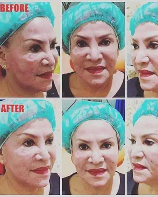 Instagram.com/mpok.atiek