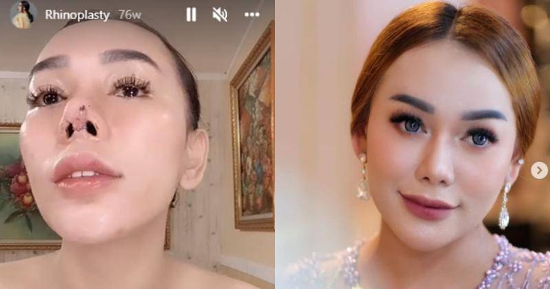 Instagram.com/bebby_fey