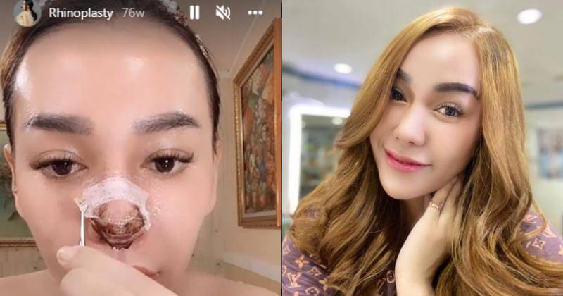 Instagram.com/bebby_fey