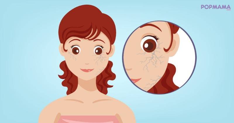 Popmama.com/Aristika