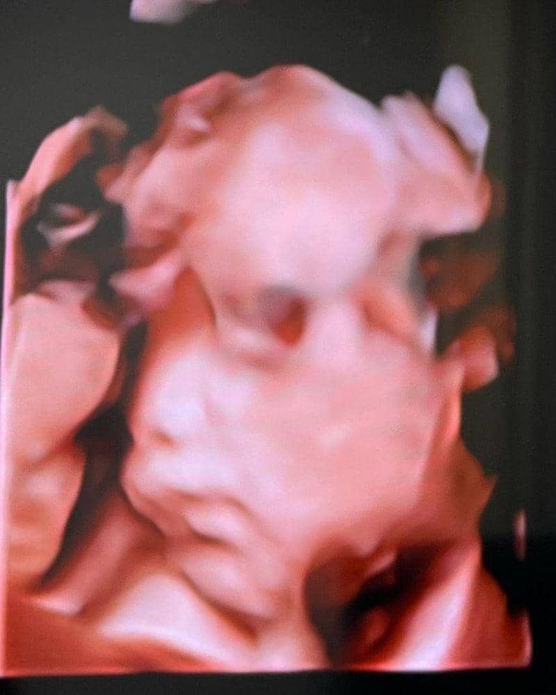 Instagram.com/@arnoldpo