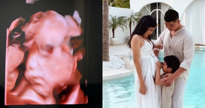 Instagram.com/@arnoldpo