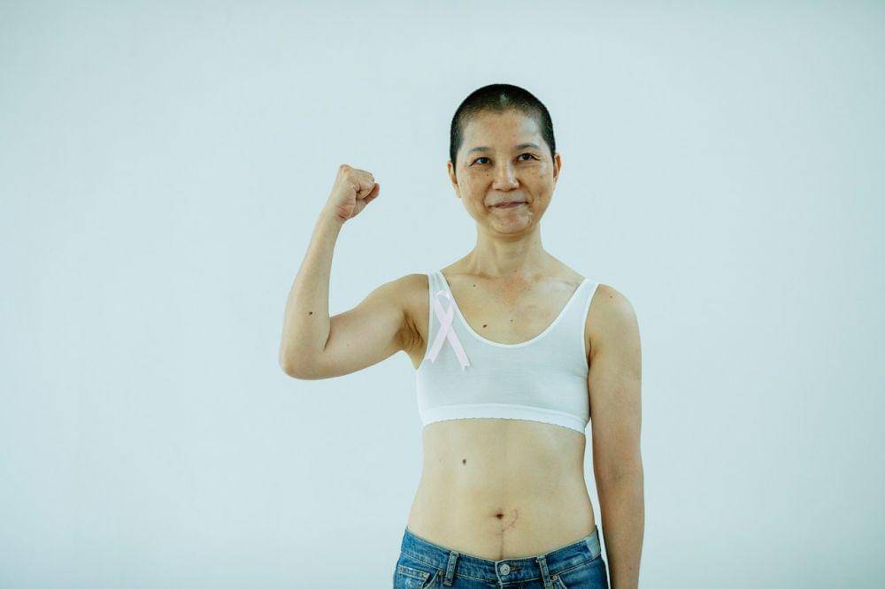 Apakah Kanker Payudara Bisa Sembuh? Ini Penjelasannya