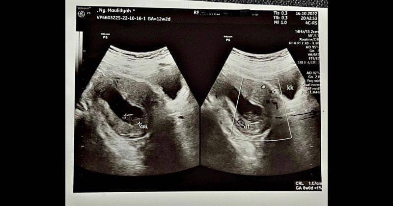 Instagram.com/viavallen