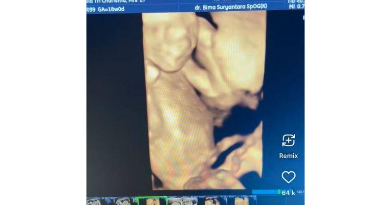 Instagram/Nellakharisma