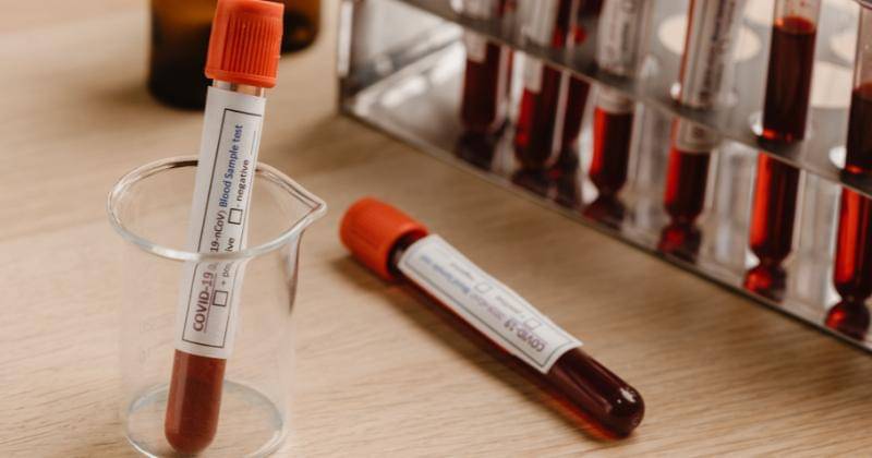 Pexels/Chokniti Khongchum