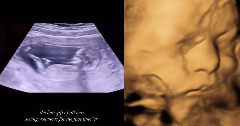 Instagram.com/AamandaZahra