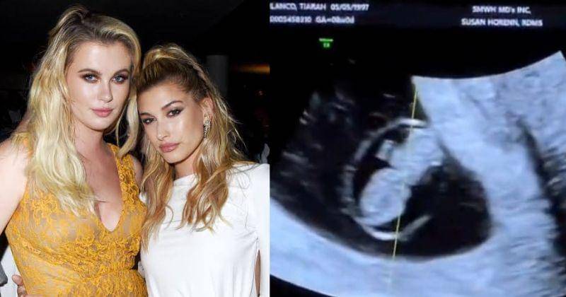 Instagram.com/IrelandIrelandIreland