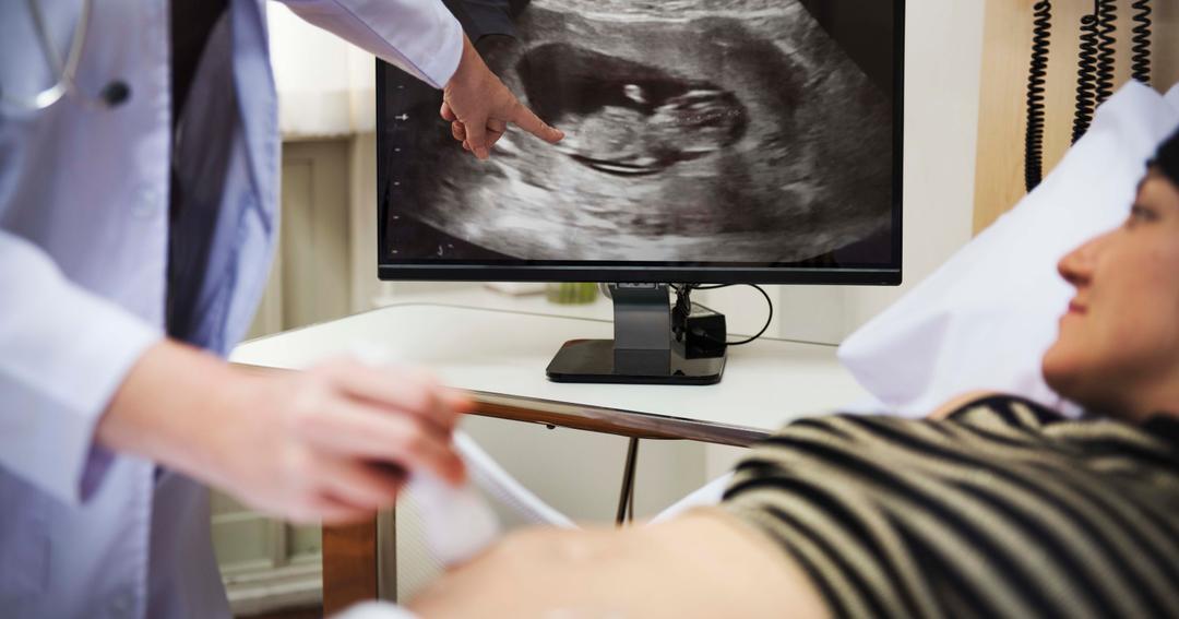Kapan Waktu Normal Ketuban Pecah? Ini Penjelasan Dokter!
