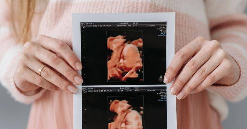 Pexels.com/Pavel Danilyuk