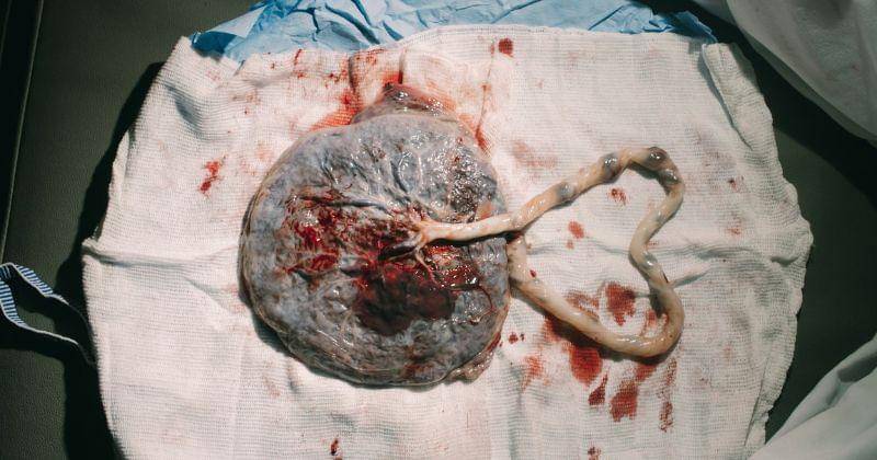 Unsplash/João Paulo de Souza Oliveira