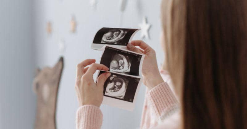 IVF Alami dan IVF Tradisional, Apa Bedanya? Cari Tahu di Sini!
