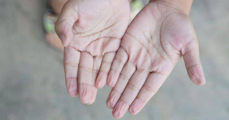 medicalnewstoday.com