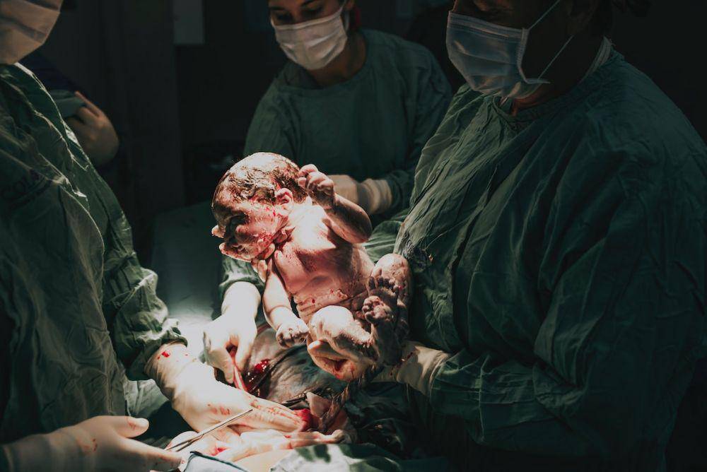 Persiapan sebelum operasi caesar (pexels.com./Natalia Olivera)