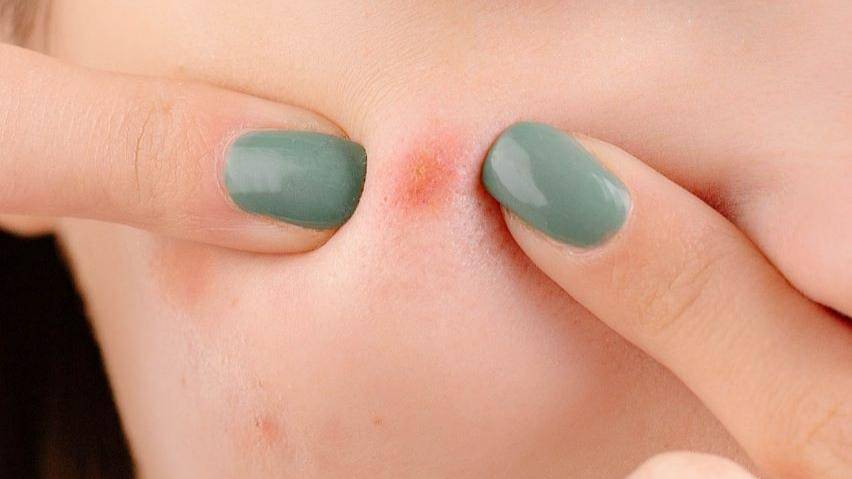 Pexels/anna-nekrashevich