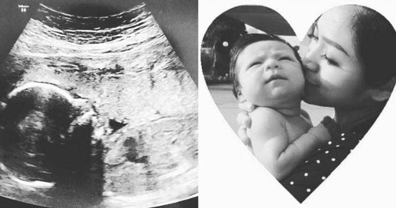 Instagram.com/wetblueberryy