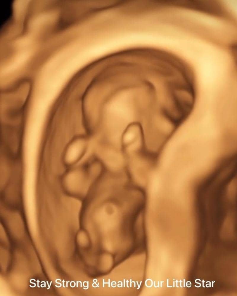 Instagram.com/melisahart_