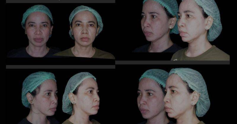 Dok. PT Regenesis Indonesia