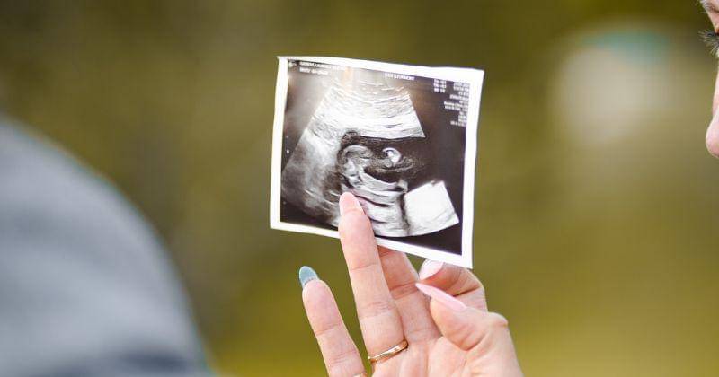 Unsplash/Dave Goudreau