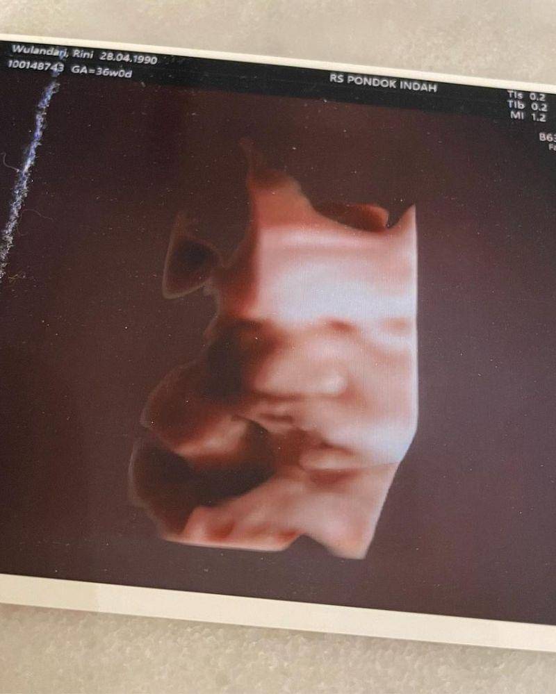 Instagram.com/@rinni_w