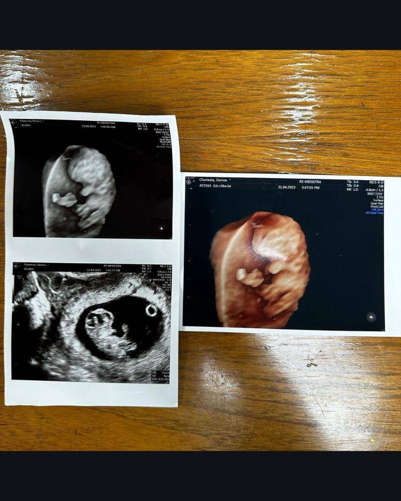 Instagram.com/denisechariesta91