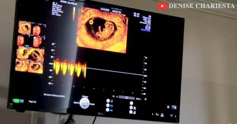 Youtube.com/ denise chariesta